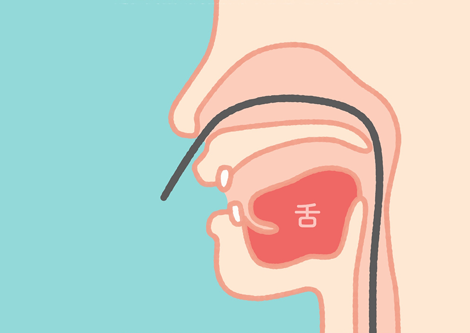 当院の内視鏡検査・治療の特徴01_経鼻内視鏡を使った検査