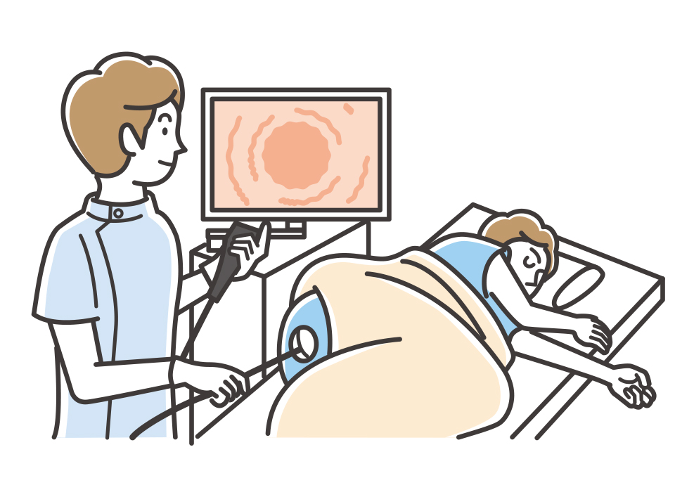 検査の種類02_下部消化管内視鏡（大腸カメラ検査）