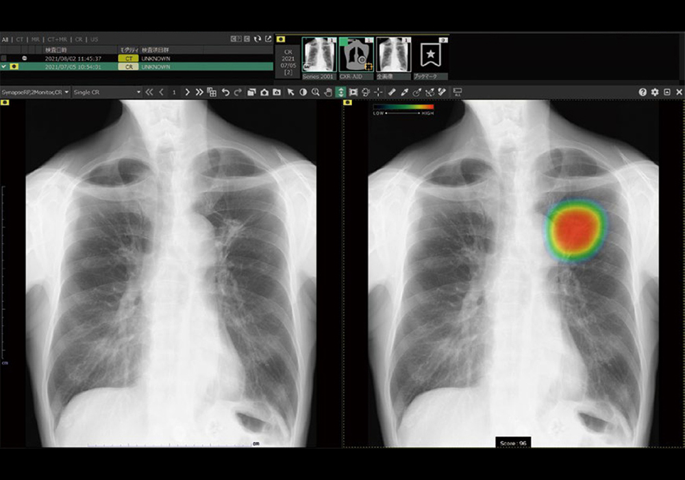 設備紹介01_胸部Ｘ線画像診断システム（EX-Mobile）